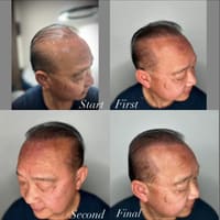Scalp Micropigmentation By ROB - permanent makeup work