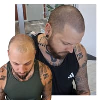 Scalp & Skin Artistry Scalp Micropigmentation - permanent makeup work