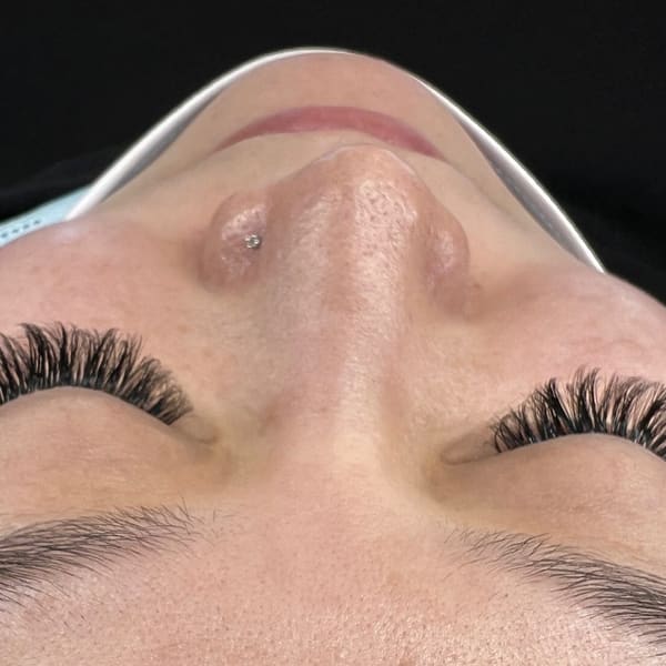 SCALP SKIN SCAR MicroPigment & Image Center - permanent makeup in Reno, NV