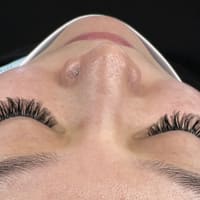 SCALP SKIN SCAR MicroPigment & Image Center - permanent makeup work