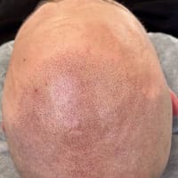 Scalp3D - permanent makeup work