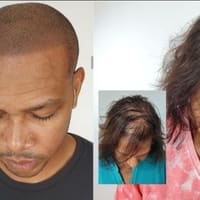 Scalpp Clinic : Scalp Micropigmentation Houston - permanent makeup work