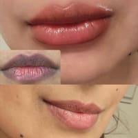 Scar Solutions 209 - permanent makeup work