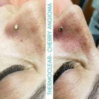 skinSPArations - permanent makeup work