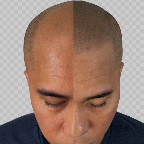 SMP-NYC [Scalp MicroPigmentation] - permanent makeup in Ridgewood, NY