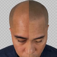 SMP-NYC [Scalp MicroPigmentation] - permanent makeup work