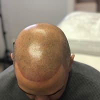 SMP Scalp Studio - permanent makeup work