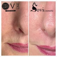 SOVI Cosmetic - permanent makeup work
