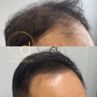 Studio Dotz On - permanent makeup work