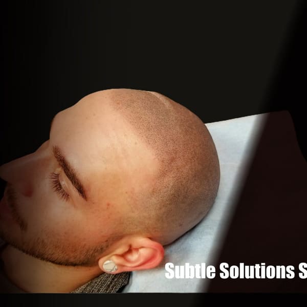 Subtle Solutions Scalp Micropigmentation - permanent makeup in Anthem, AZ