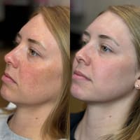 Symmetry Aesthetics and Wellness - permanent makeup work