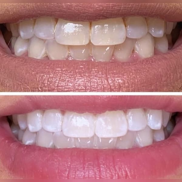 Symmetry Beauty - permanent makeup in Lynnwood, WA