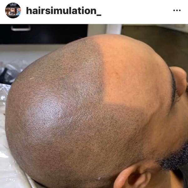 The Hair Simulation Company - permanent makeup in Atlanta, GA