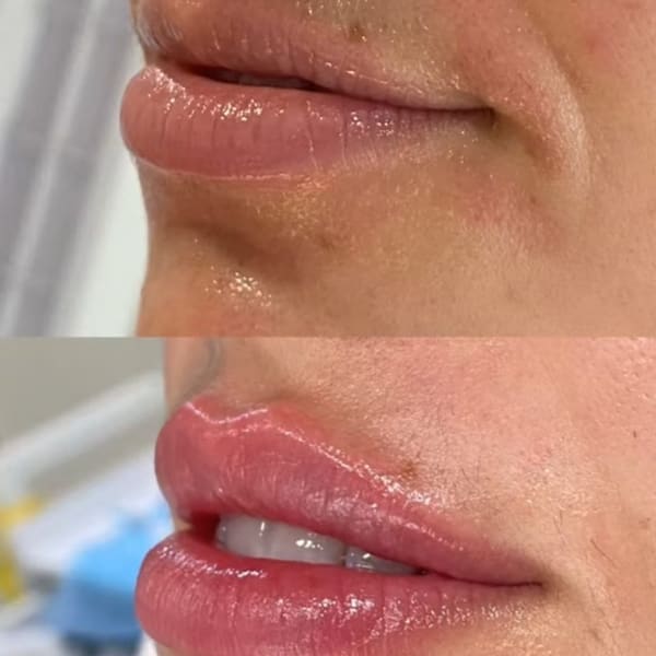 The Med Spa Waco - permanent makeup in Waco, TX