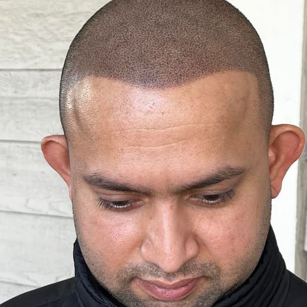 The Micropigment Studio Hair Replacement Service (SMP) and Permanent Makeup, SMP Artist Janette - permanent makeup in San Jose, CA
