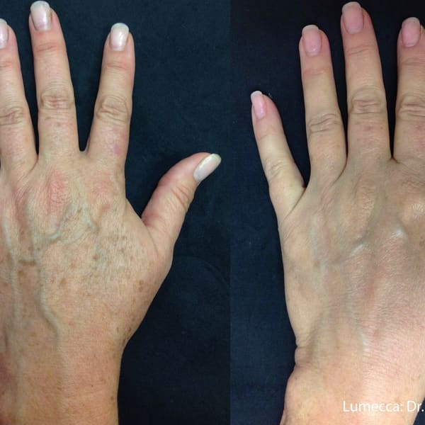 The Utah Spa - permanent makeup in Provo, UT