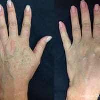 The Utah Spa - permanent makeup work