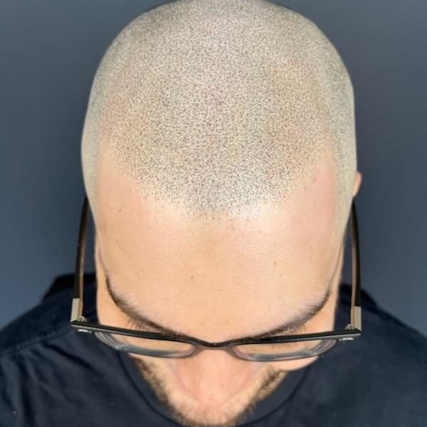 Tint Studio - Scalp Pigmentation & ParaMedical Tattoos - permanent makeup in Lanham, MD
