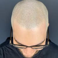 Tint Studio - Scalp Pigmentation & ParaMedical Tattoos - permanent makeup work
