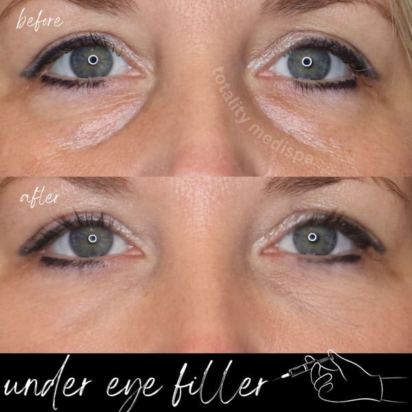 Totality Medispa - permanent makeup in Charleston, SC