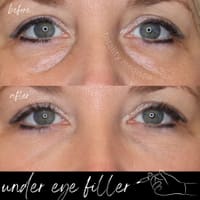 Totality Medispa - permanent makeup work