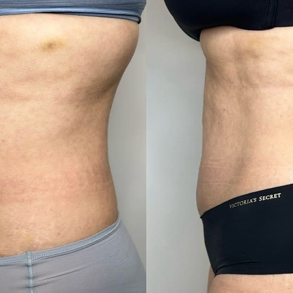 TS Browshes Esthetics and Laser - permanent makeup in Pembroke Pines, FL