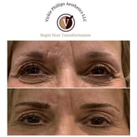 Vickie Phillips Aesthetics LLC - permanent makeup work