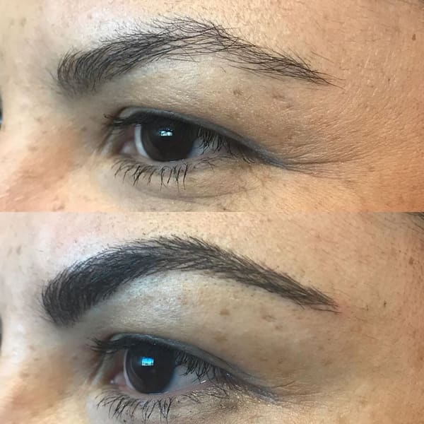 Vogue Laser Clinic - permanent makeup in Loveland, CO