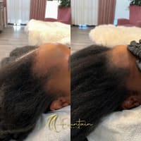 Women’s Scalp Micropigmentation - Fountain of Youth - permanent makeup work
