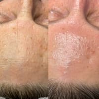 Yuri Conde PMU & Esthetician NJ - permanent makeup work
